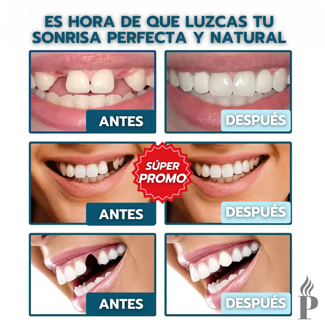 Carillas Dentales Snap On Smile - Sonrisa Perfecta + Envio Gratis