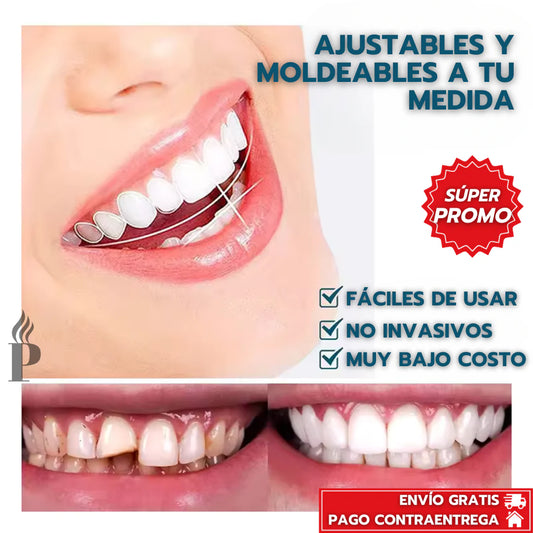 Carillas Dentales Snap On Smile - Sonrisa Perfecta + Envio Gratis