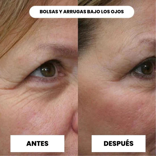 ✨ LumiSkin™ Mascarilla Envolvente de Colágeno ¡Despierta Luciendo 10 Años Más Joven! ✨